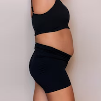 Photo of Fernanda L. before